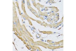 Immunohistochemistry of paraffin-embedded mouse heart using SFRP4 antibody (ABIN5973810) at dilution of 1/100 (40x lens). (SFRP4 Antikörper)