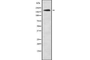 Western blot analysis NRXN3 using Jurkat whole cell lysates (Neurexin 3 Antikörper  (Internal Region))