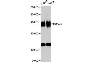Western blot analysis of extracts of various cell lines, using HDAC6 antibody (ABIN1872957) at 1:1000 dilution. (HDAC6 Antikörper)