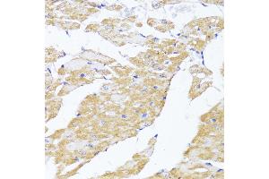 Immunohistochemistry (IHC) image for anti-Mitochondrial Antiviral Signaling Protein (MAVS) (AA 1-65) antibody (ABIN6143583)