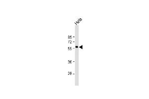 Western Blotting (WB) image for anti-MAP Kinase Interacting serine/threonine Kinase 2 (MKNK2) (AA 402-432), (C-Term) antibody (ABIN391228)