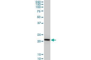 Western Blotting (WB) image for anti-Ribosomal Protein S5 (RPS5) (AA 106-204) antibody (ABIN519885)