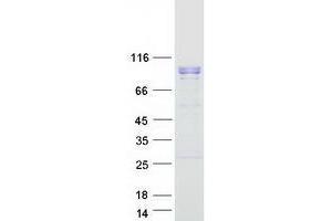 Validation with Western Blot (WDR36 Protein (Myc-DYKDDDDK Tag))