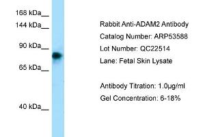 Western Blotting (WB) image for anti-ADAM Metallopeptidase Domain 2 (ADAM2) (N-Term) antibody (ABIN2785462) (ADAM2 Antikörper  (N-Term))