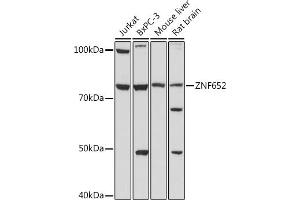 Western blot analysis of extracts of various cell lines, using ZNF652 antibody (ABIN7271517) at 1:1000 dilution. (ZNF652 Antikörper)