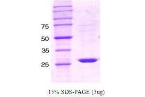 Figure annotation denotes ug of protein loaded and % gel used. (SHP1 Protein)
