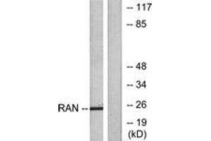 Western blot analysis of extracts from LOVO cells, using RAN Antibody. (RAN Antikörper  (AA 167-216))