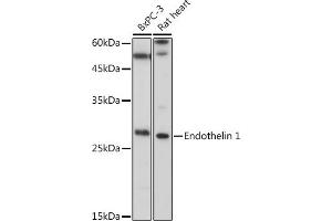 Western blot analysis of extracts of various cell lines, using Endothelin 1 antibody (ABIN3021075, ABIN3021076, ABIN3021077 and ABIN6213940) at 1:1000 dilution.