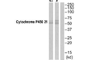 Western blot analysis of extracts from Jurkat/HeLa cells, using CYP21A2 antibody. (CYP21A2 Antikörper  (C-Term))