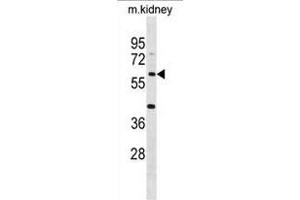 ACSM4 Antibody (C-term) (ABIN1881045 and ABIN2838825) western blot analysis in mouse kidney tissue lysates (35 μg/lane).