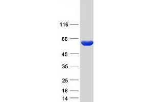 Western Blotting (WB) image for 2-Hydroxyacyl-CoA Lyase 1 (HACL1) protein (Myc-DYKDDDDK Tag) (ABIN2722399)