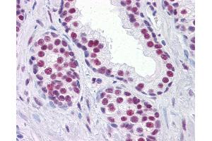 Anti-RUNX2 antibody IHC of human prostate. (RUNX2 Antikörper  (AA 251-351))