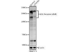 Western Blotting (WB) image for anti-Low Density Lipoprotein Receptor (LDLR) (C-Term) antibody (ABIN7268296)