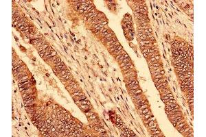 Immunohistochemistry (IHC) image for anti-Platelet-Activating Factor Acetylhydrolase 1b, Catalytic Subunit 2 (30kDa) (PAFAH1B2) (AA 2-229) antibody (ABIN7163605)