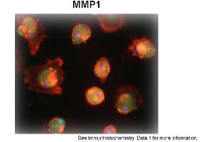 Sample Type: Human Macrophange CellsGreen: primaryRed: phallodinBlue: DAPIYellow: green/redPrimary Dilution: 1:200Secondary Antibody: anti-Rabbit IgG-FITCSecondary Dilution: 1:1000Image Submitted By: Milan FialaUniversity of California, Los Angeles (MMP1 Antikörper  (N-Term))