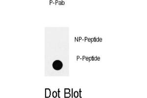 Dot Blot (DB) image for anti-Insulin Receptor Substrate 2 (IRS2) (pTyr978) antibody (ABIN3001883)