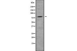 Western blot analysis IL31R using HepG2 whole cell lysates