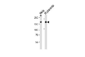 Western blot analysis of lysates from Hela cell line and human placenta tissue lysate(from left to right), using COL4A1 Antibody (N-term) A. (COL4A1 Antikörper  (N-Term))