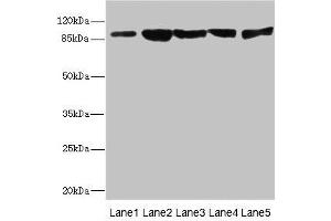 Western blot All lanes: DSC2 antibody at 3. (Desmocollin 2 Antikörper  (AA 520-690))