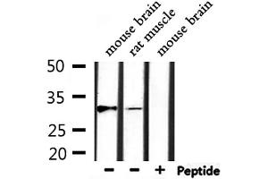 Western blot analysis of extracts from rat muscle, mouse brain, using MARCH1 Antibody. (MARCH1 Antikörper  (C-Term))