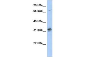 WB Suggested Anti-H1FOO Antibody Titration: 0. (H1FOO Antikörper  (N-Term))