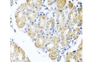 Immunohistochemistry of paraffin-embedded Human stomach using BNIP3L Polyclonal Antibody at dilution of 1:100 (40x lens). (BNIP3L/NIX Antikörper)