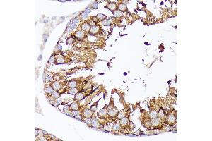 Immunohistochemistry of paraffin-embedded rat testis using Nectin 2/CD112 Rabbit mAb (ABIN7269432) at dilution of 1:100 (40x lens). (PVRL2 Antikörper)