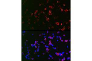 Immunofluorescence analysis of Raji cells using CD22 Rabbit pAb (ABIN6131253, ABIN6138143, ABIN6138144 and ABIN6221471) at dilution of 1:150 (40x lens). (CD22 Antikörper  (AA 708-847))