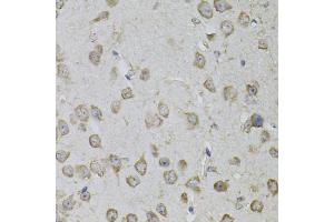 Immunohistochemistry of paraffin-embedded mouse brain using TRPC3 antibody (ABIN5995383) (40x lens). (TRPC3 Antikörper)