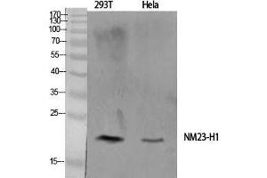 Western Blot (WB) analysis of specific cells using NM23-H1 Polyclonal Antibody.