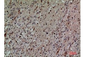 Immunohistochemical analysis of paraffin-embedded human-brain, antibody was diluted at 1:100. (CD58 Antikörper  (Internal Region))