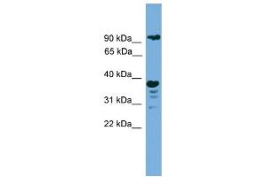 WB Suggested Anti-LAMP1  Antibody Titration: 0. (LAMP1 Antikörper  (N-Term))