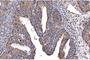 IHC analysis of HGS using anti-HGS antibody (ABIN7601206). (HGS Antikörper  (AA 3-777))