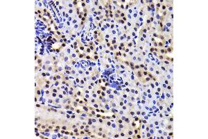 Immunohistochemistry of paraffin-embedded Mouse kidney using GABPB1 antibody at dilution of 1:100 (x400 lens). (GABPB1 Antikörper)