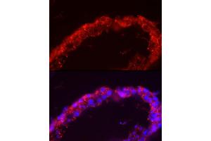 Immunofluorescence analysis of human testis cells using SP Rabbit pAb (ABIN3022967, ABIN3022968, ABIN1513554 and ABIN6219322) at dilution of 1:150 (40x lens). (SPAM1 Antikörper  (AA 100-300))