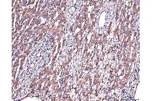 IHC analysis of Alpha 2 Antiplasmin/SERPINF2 using anti-Alpha 2 Antiplasmin/SERPINF2 antibody (ABIN7601808).