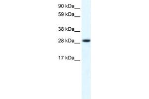 WB Suggested Anti-FHL1 Antibody Titration:  0. (FHL1 Antikörper  (C-Term))