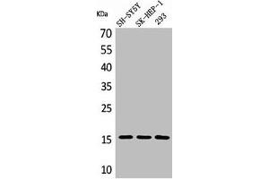 Western Blot analysis of SH-SY5Y 293 SK-HEP-1 cells using Phospho-Synuclein-α (Y125) Polyclonal Antibody (SNCA Antikörper  (pTyr125))