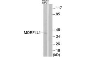 Western blot analysis of extracts from mouse kidney cells, using MORF4L1 Antibody. (MORF4L1 Antikörper  (AA 31-80))