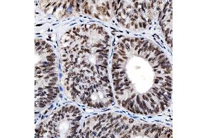IHC analysis of SNRNP200 using anti-SNRNP200 antibody (ABIN7602032). (SNRNP200 Antikörper  (AA 557-2129))