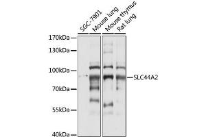 Western blot analysis of extracts of various cell lines, using SLC44A2 antibody (ABIN6291931) at 1:1000 dilution.