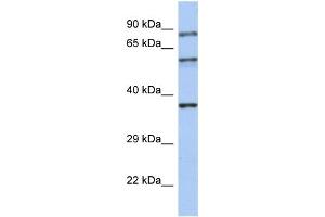 WB Suggested Anti-RPH3A Antibody Titration:  0.