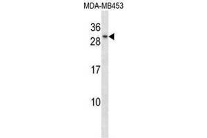 TGIF2 Antibody (C-term) western blot analysis in MDA-MB453 cell line lysates (35 µg/lane).