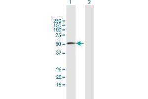 Western Blot analysis of RBM23 expression in transfected 293T cell line by RBM23 MaxPab polyclonal antibody. (RBM23 Antikörper  (AA 1-424))