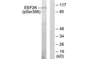 Western blot analysis of extracts from HeLa cells treated with serum 10 % 15', using eEF2K (Phospho-Ser366) Antibody. (EEF2K Antikörper  (pSer366))