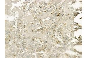 ABIN6259486 and ABIN6273754 at 1/100 staining human normal lung tissue by IHC-P.