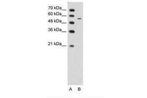 Image no. 1 for anti-Carbohydrate (N-Acetylglucosamine 6-O) Sulfotransferase 7 (CHST7) (AA 256-305) antibody (ABIN203380) (CHST7 Antikörper  (AA 256-305))