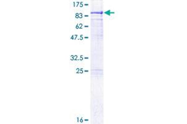 METTL3 Protein (AA 1-580) (GST tag)