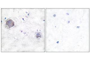 Immunohistochemistry (IHC) image for anti-Notch 1 (NOTCH1) (Cleaved-Val1754), (Internal Region) antibody (ABIN1853472) (Notch1 Antikörper  (Cleaved-Val1754, Internal Region))