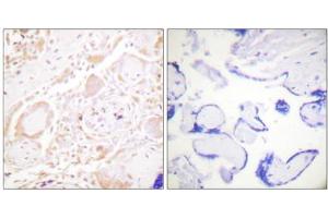 Immunohistochemistry analysis of paraffin-embedded human placenta tissue using GATA3 antibody. (GATA3 Antikörper)